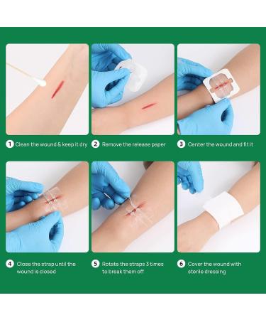 5pcs Zip Stitch Suture Free Wound Closure Strips | Butterfly Bandages for Emergency Laceration Repair - First Aid Kit Essential - Buy Online on GoSupps.com