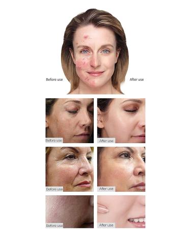 Puicmlna Microneedling Pen with 12 Disposable Needles - 0.1mm Size - 42-pin, 36-pin, 12-pin, Nano Cartridges Included - Buy Online on GoSupps.com