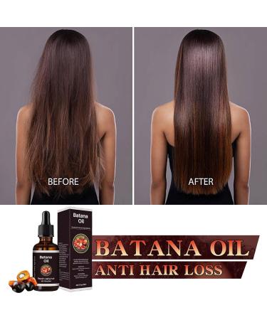 Batana Oil For Hair Growth 30ml Batana Hair Oil Dry & Damaged Hair Batana Oil For Enhanced Hair Grow Longer Healthier Fuller & Stronger Hair For Women Men Batana Hair Oil - Buy Online on GoSupps.com