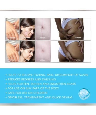 Sure Medical Advanced Silicone Scar Gel 60g - Ideal for Keloid & Acne Scars - Non-Greasy Formula for New & Old Scars - Buy Online on GoSupps.com