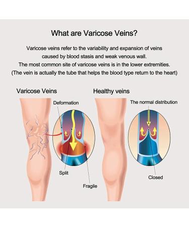 Sxhmsal Compression Stockings Class 2 - Knee High Varicose Vein Socks for Men & Women | 23-32 mmHg | Edema & Pregnancy Relief | Black - Size M - Buy Online on GoSupps.com