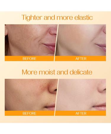  Generisch Moisturizing Body Cream Non Greasy Skin Lotion | Brightening Body Cream for Daily Care of Arms Neck Elbow and Knees for Men and Women - Buy Online on GoSupps.com