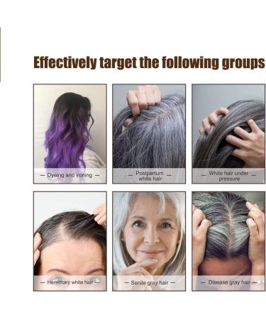 S rum Anti-Cheveux Gris Anti-Greying Hair Serums S rum Pour Cheveux Gris Huile Capillaire R paratrice Serum Cheveux Natural Hair Darkening Serum Natural Ganoderma Hair Oil (3) - Buy Online on GoSupps.com