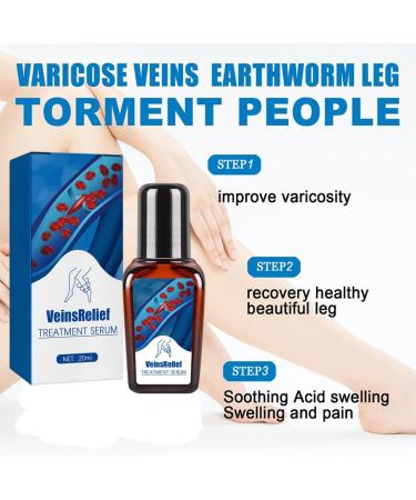 Ambayz Vein Relief Treatment for Varicose Veins - Improve Blood Circulation | 1 Piece - Buy Online on GoSupps.com