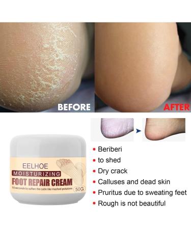 100% Natural Foot Care Cream for Dry Skin & Cracked Heels | Glycerin Infused | Soothes & Refreshes Tired Feet - Buy Online on GoSupps.com