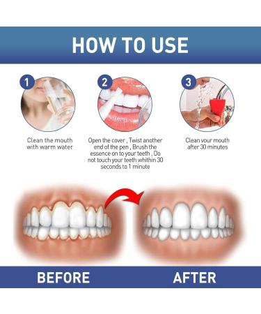 Whitening Gel Pen Teeth Whitening Pen Easy and Effective Teeth Whitening Teeth Whitening Pen Whiten Teeth Easily Teeth Care Whitening (5) - Buy Online on GoSupps.com
