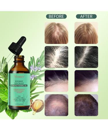 Rosemary Oil for Hair Rosemary Hair Serum Anti Hair Loss Trengthen Hair Roots Hair Growth Oil for Hair Rapid Growth and Thickening Hair Growth Serum for Men and Women - Buy Online on GoSupps.com