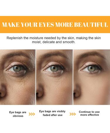 Turmeric Eye Cream Anti Aging Eye Cream With Vitamin C Eye Cream For Dark Circles And Puffy Eyes Turmeric Cream For Radiant&Glowing Skin Under Eye Cream Dark Circle Eye Cream All Skin Types - Buy Online on GoSupps.com