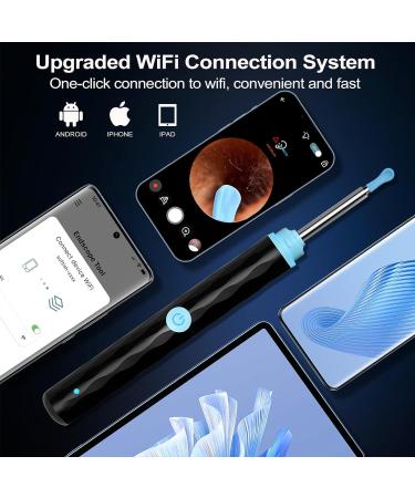 Premium Ear Wax Removal Kit with 1296P Camera - Safe Ear Cleaning Tools for iPhone Android & More - Buy Online on GoSupps.com