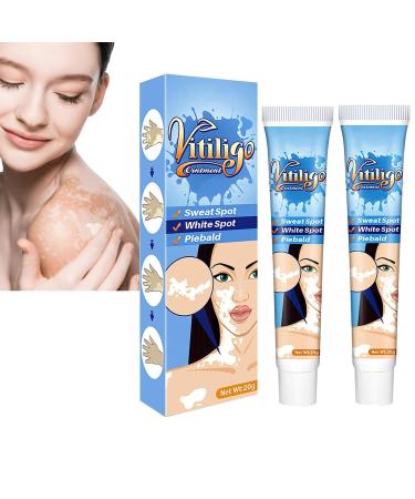 Vitiligo Therapy Cream Vitiligo Treatment Vitiligo Care Cream for Reduce White Spots and Improve Skin Pigmentation Vitiligo Soothing Ointment White Spot Cream (2Pcs)