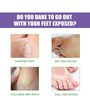 Foot Mask Foot Peel Mask Lavender & VC Exfoliating Foot Peel Mask Lavender Exfoliating Foot Mask Peel Feet Peeling Mask Exfoliating Foot Mask Foot Moisturizing Mask - Buy Online on GoSupps.com