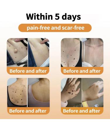 Bee Venom 1-3PCS Bee Venom Cream Bee Venom Repair Cream Bee Venom Professional Cream Hydrating Moisturizing Cream 1pc - Buy Online on GoSupps.com