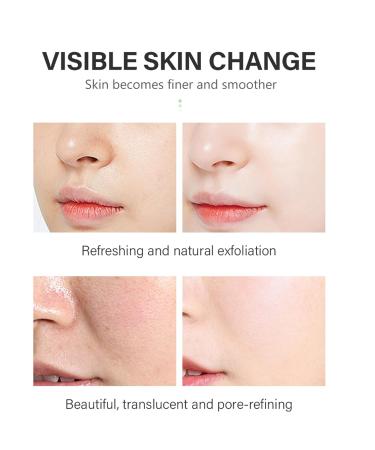 Salicylic Acid Solution 2% (30 mL) - Gentle Exfoliating Serum for Clearer Skin | Daily Use Facial Serum - Buy Online on GoSupps.com