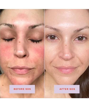 Tower 28 SOS Daily Facial Spray | Travel-Size | Soothe Irritation and Inflammation | pH Balancing Toner | Hypochlorous Acid | 1 Fl Oz - Buy Online on GoSupps.com