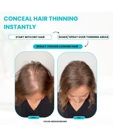 SureThik Hair Thickening Fiber Starter Package - Includes Medium Brown Fiber Holding Spray & Application Tools - Perfect for Instant Volume & Coverage - Buy Online on GoSupps.com