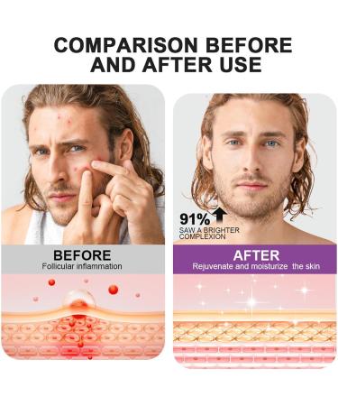 Jingmiger Hydration of the head leather 20 g fatfree restorative for head leather for daily routine home shower travel living room women men seasonal relief - Buy Online on GoSupps.com