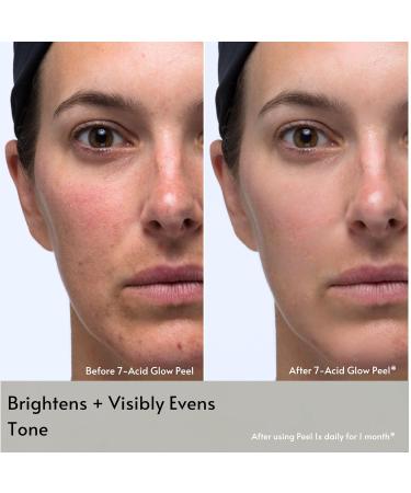 Clarks Botanicals 7-Acid Daily Glow Peel: AHA BHA Chemical Peel for Face Purify Pores Regenerate & Brighten Skin All Skin Types 4.2 Oz (Pack of 1) 4.2 Fl Oz (Pack of 1) - Buy Online on GoSupps.com