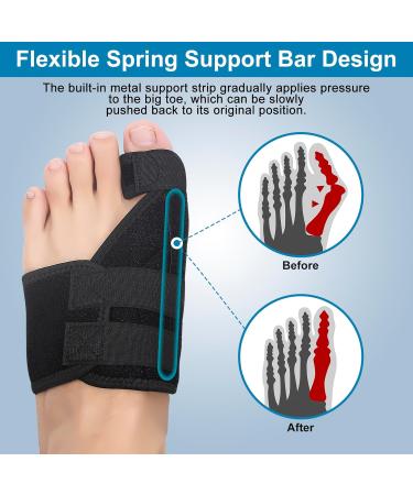 Yasdyri Bunion Corrector - Big Toe Straightener for Pain Relief and Toe Alignment - Women and Men Bunion Splint - Black (Right) - Buy Online on GoSupps.com