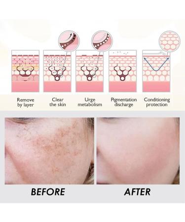 Fyearfly Facial Serum Capsules 60 Pieces Nicotinamide Capsules Skin Whitening Fading Spots Moisturizing Soothing Skin Care Capsules with 2 Storage Bottles - Buy Online on GoSupps.com