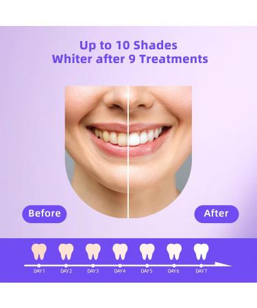 Teeth Whitening Gel Refill Kit - Non-Sensitive 4 Pens 44% Carbamide Peroxide | Fast International Shipping - Buy Online on GoSupps.com