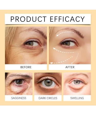  ZHJZGS Set of 6 eye creams to eliminate under-eye bags brighten moisturize firm reduce fine lines wrinkles and puffiness - Buy Online on GoSupps.com