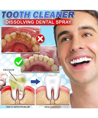 Calculus Free Dental Spray | Portable Teeth Cleaner & Oral Irrigator - 1pc - Buy Online on GoSupps.com