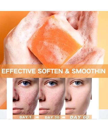 IZBEAUVO Turmeric Soap Nature Turmeric Soap Turmeric Brightening Soap Turmeric Soap Bar Ginger Extract Soap For Face & Body Dark Spot Corrector Remover Moisturizing Erase Fine Lines Firming - Buy Online on GoSupps.com