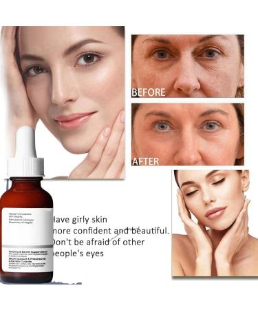 Face Moisturiser - Soothing & Barrier Support Serum Barrier Serum Skin Barrier Repair Cream Tightening Serum Serum Face Anti Redness Serum Facial Serum Face Moisturiser Serum Face Skincare Serum - Buy Online on GoSupps.com