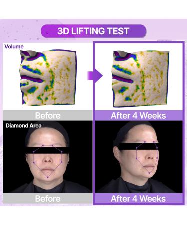 BIOHEAL BOH Probioderm 3D Lifting Ampoule 1.01 fl oz (30 ml) | Advanced Elasticity Serum for Sculpted Firm Skin | Powerful 3D Lifting Formula with Probiotics & Peptides for Daily Skincare - Buy Online on GoSupps.com