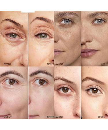 Anti-Dark Circle Eye Contour Cream Special for Sensitive Skin - Nourishing Face Moisturizer for Dry Mature Skin for Women and Men Daily Use Day and Night - Buy Online on GoSupps.com