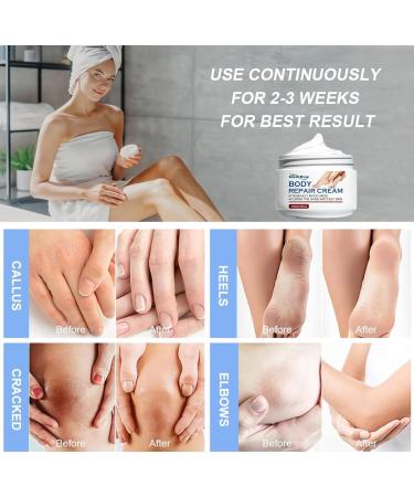 Urea Foot Cream Urea Cream for Feet with Coconut Oil Foot Cream for Cracked Heels and Dry Skin Cracked Heel Repair Cream for Callus Remover & Soften Protect Dry and Callused Feet & Hands - Buy Online on GoSupps.com