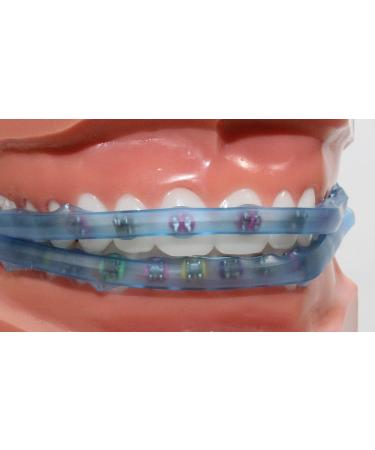 Element Comfort Cover Braces Guard - Snap On Mouth Protector for Braces (Blue) - Buy Online on GoSupps.com