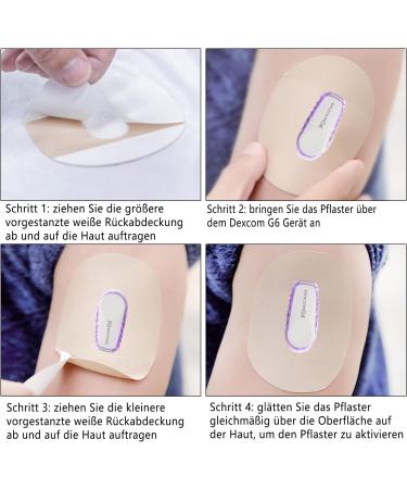 Dexcom G6 Adhesive Patches - 30 Pack | Waterproof & Skin Friendly Overpatch CGM Stickers | Extended 10-14 Day Protection | Easy Application - Buy Online on GoSupps.com