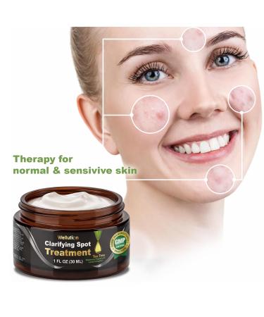 Cystic Acne Treatment & Scar Remover - USA Made Severe Acne Cleanser with Tea Tree Oil - Prevent Breakouts - Natural Pimple Cream - Buy Online on GoSupps.com
