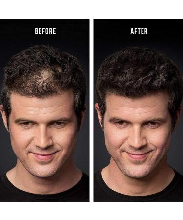 Dark Brown Hair Building Fibers for Thinning Hair, Bald Spots - Keratin Hair Re-growth Powder for Men and Women - Buy Online on GoSupps.com