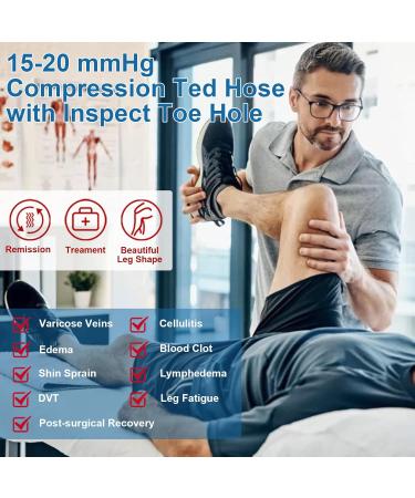 Ted Hose Compression Stockings - Thigh High Anti-Embolism Socks for Men & Women - 15-20 mmHg Compression - XXL White with Inspect Toe Hole - Buy Online on GoSupps.com
