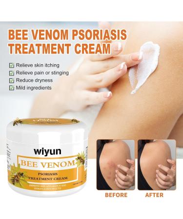 Cvreoz Bee Venom Psoriasis Cream | New Zealand Bee Venom Treatment for Psoriasis (1PC) - Fast International Shipping - Buy Online on GoSupps.com