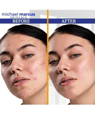 Michael Marcus Hydromarine Vitamin C Face Serum - Anti-Aging Dark Spot Reduction & Skin Brightening with Hyaluronic Acid & Peptides - 30ml - Buy Online on GoSupps.com