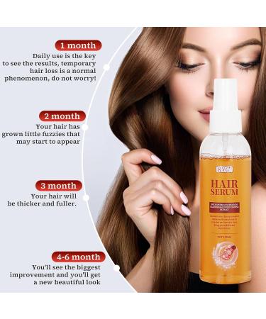 KVG Natural Hair Growth Spray | Best Hair Loss Treatment for Women & Men | Nourishing Product for Thinning Damaged Dry & Oily Hair (5.07 Fl.Oz - Buy Online on GoSupps.com