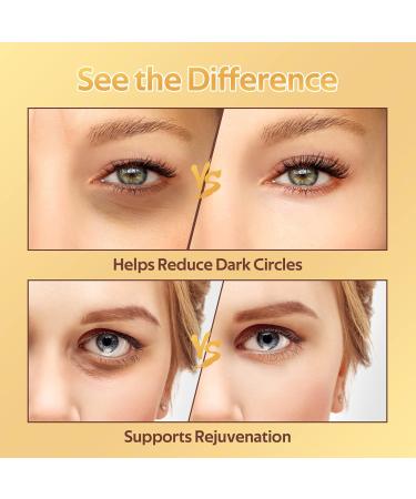 24K Gold Under Eye Treatment Masks Eye Masks for Dark Circles Crystal Gold Powder Gel Collagen for Under Eye Wrinkles Remove Eye Bags Hydrating Puffy Eyes 20 Pieces/10 Pairs - Buy Online on GoSupps.com