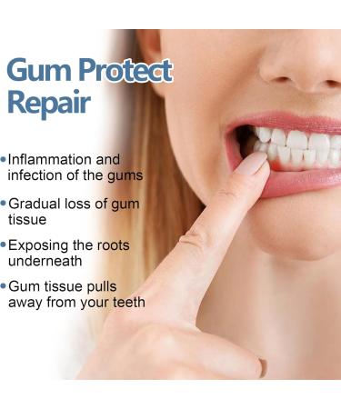  Hengxuan Pack of 4 gum repair gels tooth repair gel gum gel deep gum cleaning - Buy Online on GoSupps.com