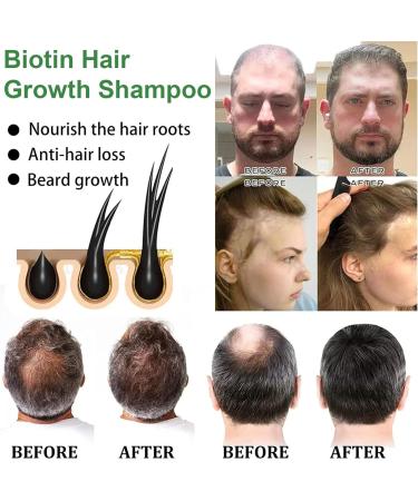Biotin Shampoo for Hair Growth - Biotin Hair Growth Shampoo for Thinning Hair for Women & Men - Hair Growth Shampoo for Damaged Weak and Thin Hair - 100ml - Buy Online on GoSupps.com