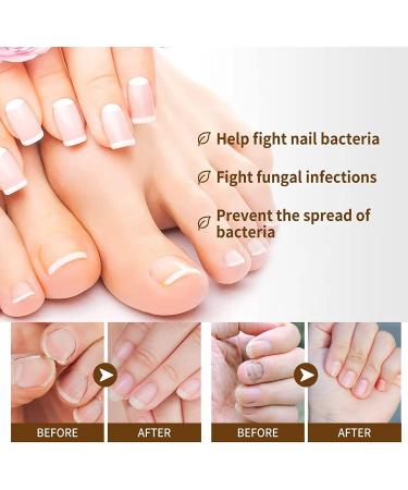 ATTDX NailGrowth DeepHealing Organic Serum NailGrowth Nail Serum Reconstrux Nail Growth Nail Growth and Strengthening Serum Nail Serum for Growth and Repair for Damaged Nails (3PC) - Buy Online on GoSupps.com