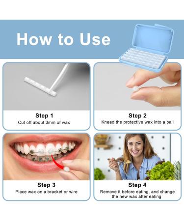 BVN Orthodontic Braces Wax - 20 Boxes | Dental Wax for Pain Relief & Irritation | 100 Stripes Blue & White - Buy Online on GoSupps.com
