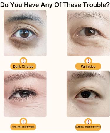 Huile Essentielle pour les Yeux la Lut ine VC S rum pour les Yeux la Lut ine Luteine Eye Essence Oil S rum pour les yeux la Lutein pour Att nuer les Poches Sous les Yeux et les Cernes - Buy Online on GoSupps.com