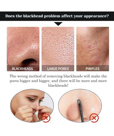 40 Blackhead Strips - Intensive Pore Cleaning for Clear Radiant Skin | Remove Blackheads with Effective Nasal Pore Strips - Buy Online on GoSupps.com