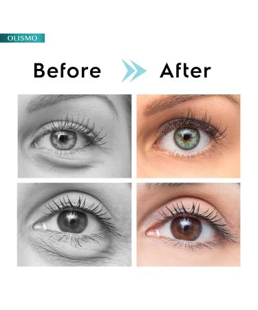 Caffeine Eye Cream for Dark Circles & Puffiness - Anti-Aging Treatment for Bags Under Eyes | Unisex Solution - Buy Online on GoSupps.com