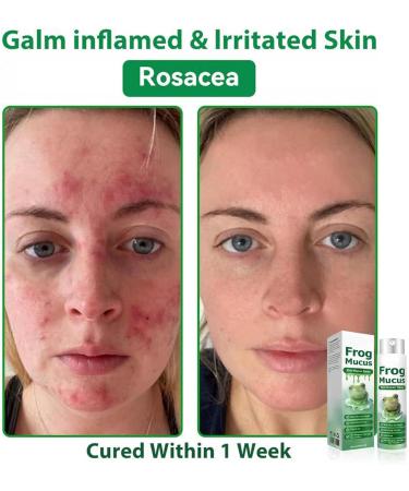 Hydrating Face Mist 20ml - Soothing for the Face | Moisturizing Care for Night Makeup Travel Post-Sport Recovery Daily Outdoor Use - Buy Online on GoSupps.com