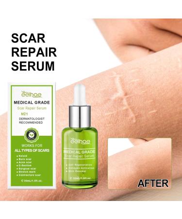 Goopgen Advanced Scar Repair Serum - Medical Grade Nature Treatment for All Types of Scars (2pcs) - Buy Online on GoSupps.com