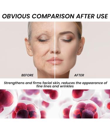  Nurvidis Face Serum Collagen Face Serum Collagen Bulb Collagen Booster Serum Collagen Lifting Bulb Reduces Wrinkles & Firms Skin Brightens Complexion Moisturize & Moisturize - Buy Online on GoSupps.com